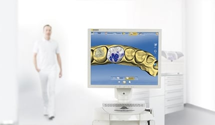 A digital dental restoration design displayed on a monitor.